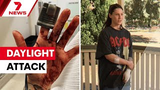 Adelaide Jogger Randomly Attacked Again, This Time Along River Torrens 7News