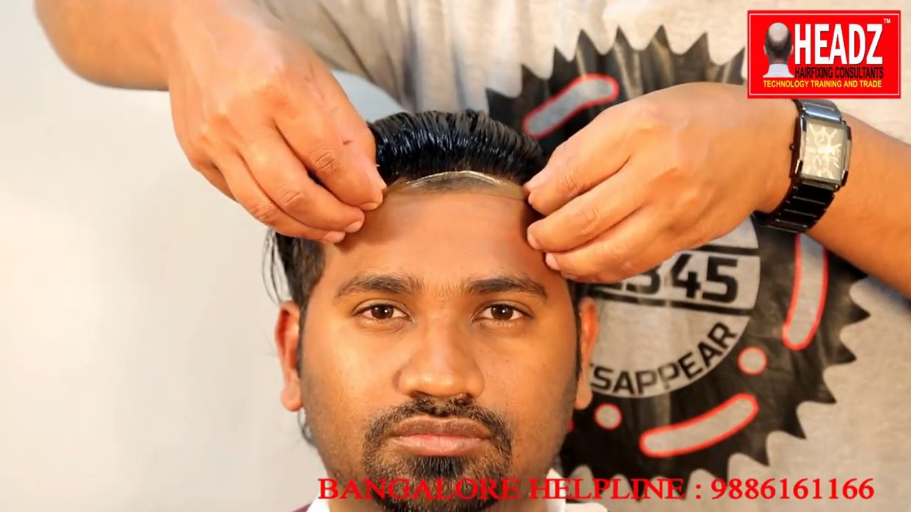 Hair transplant cost in Hyderabad  Medlinks