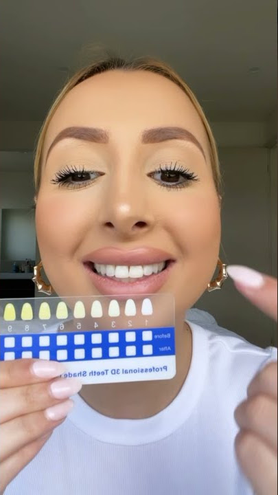 How to use our Luxe Teeth Whitening Kit