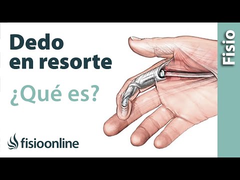 Vídeo: 5 Formas Naturales De Curar Un Dedo Atascado + Causas Y Síntomas