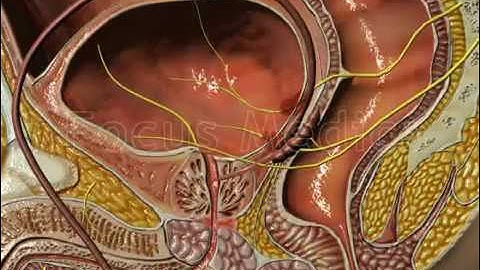 Causes of overactive bladder - Animated Atlas of BPH and OAB