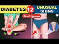 12 Unusual Symptoms of Diabetes | Diabetes Symptoms | Diabetes Mellitus |  | Diabetes Warning Signs