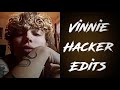 VINNIE HACKER EDITS that will leave you bald