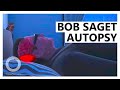 Bob Saget Head Injury Like ‘Baseball Bat to the Head’ or Someone Who Had Fallen up to 30 Feet