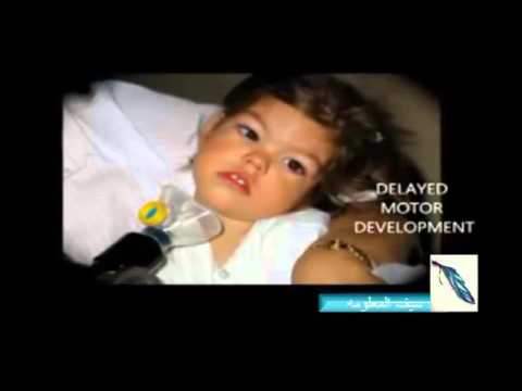 مصادر وفوائد اليود