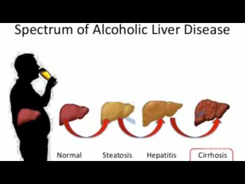 Lexapro And Alcohol Liver Damage