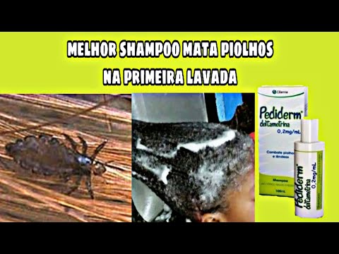 MELHOR SHAMPOO MATA PIOLHOS NA PRIMEIRA LAVADA (PEDIDERM)