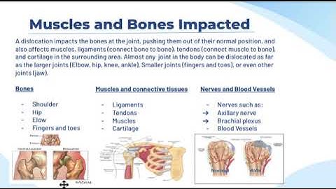 Bio 111 Lab - Teach Back Assignment 2: Sports injuries: Dislocations.