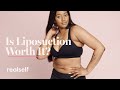 Everything you need to know about liposuction