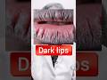 DARK LIPS ह ठ इतन क ल ह त Trending Lips Darklips DARK LIPS ह ठ इतन क ल ह त Trending Lips Darklips