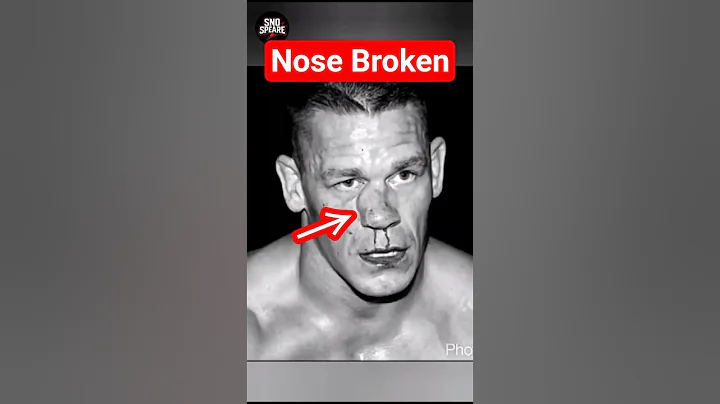 Top 3 wrestlers who suffered heavy injur! because of Seth Rollins #wwe #wweraw