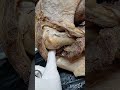Axillary nerve and sub deltoid muscle structures