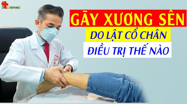 Lật sơ mi là gì hay bị gãy xương mác năm 2024