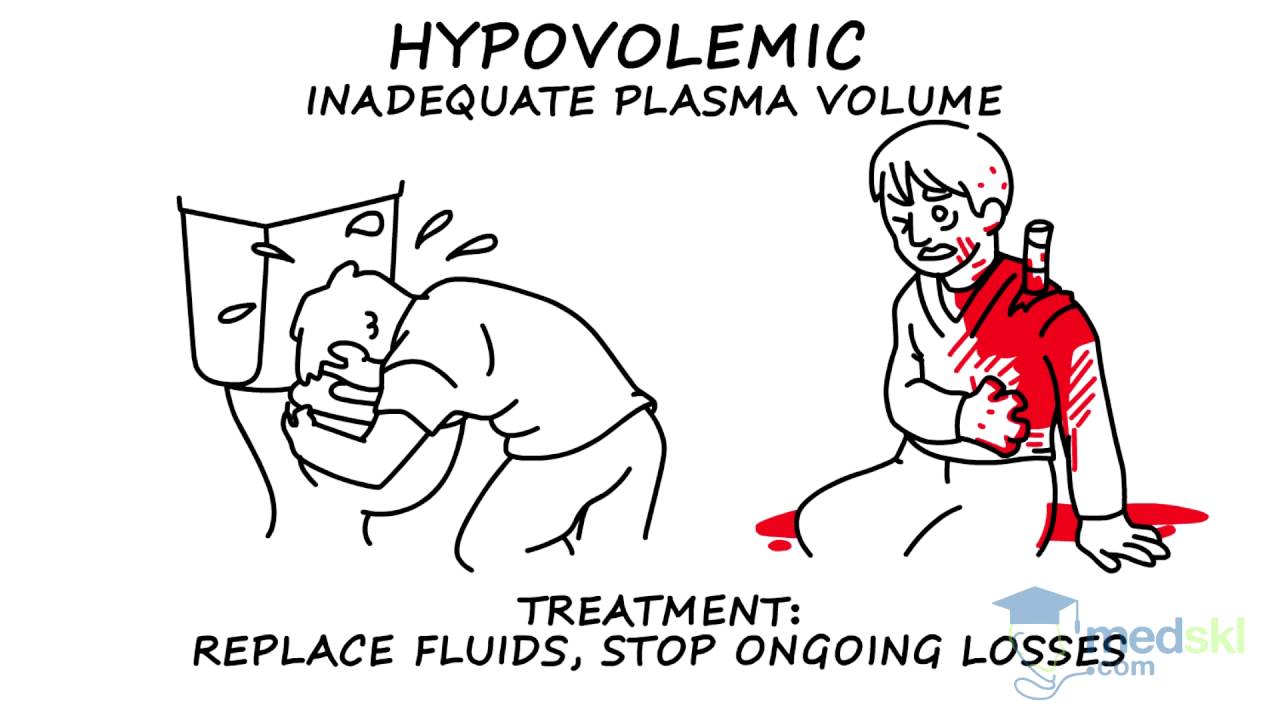 General Surgery Hypotension and Shock By Rob Woods M.D. YouTube