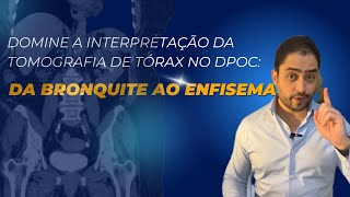 Como Identificar Sinais de DPOC em Tomografias: Guia Completo para Médicos e Estudantes