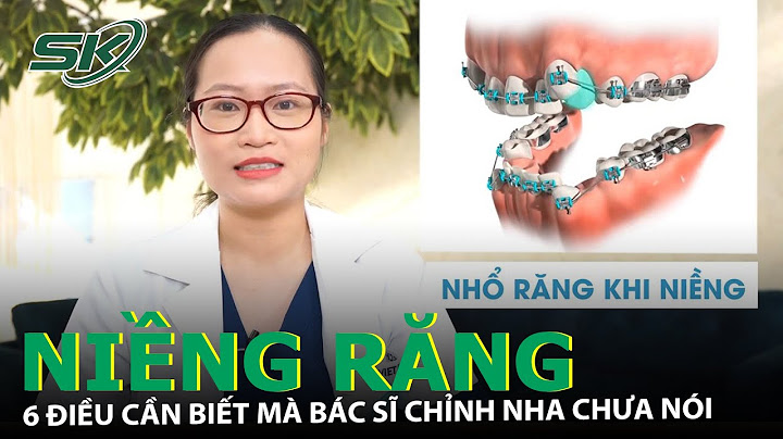 Bước răng mịn và bước răng thô là gì năm 2024