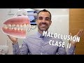 Tooth Boss | Maloclusión clase II || Ortodoncia en Murcia