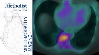 Cardiomyopathies II: Restrictive And Inflammatory (D. Shah, MD; M. Al Mallah, MD) February 2, 2021 Cardiomyopathies II: Restrictive And Inflammatory (D. Shah, MD; M. Al Mallah, MD) February 2, 2021