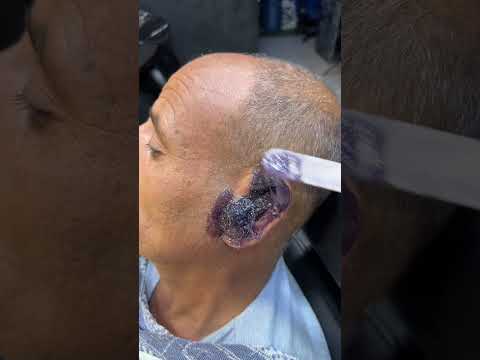 هو اي كل ده شعر ودانه       