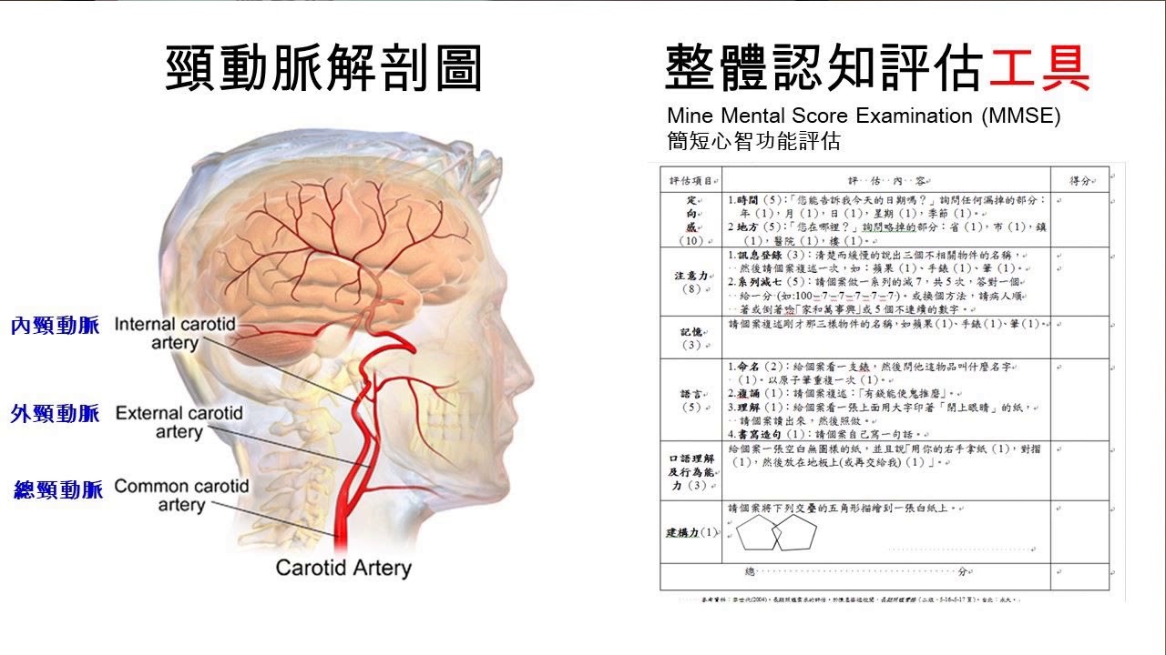 記者會實錄 高血壓且頸動脈流速較低之年長者伴隨認知功能衰退之可能風險 Youtube