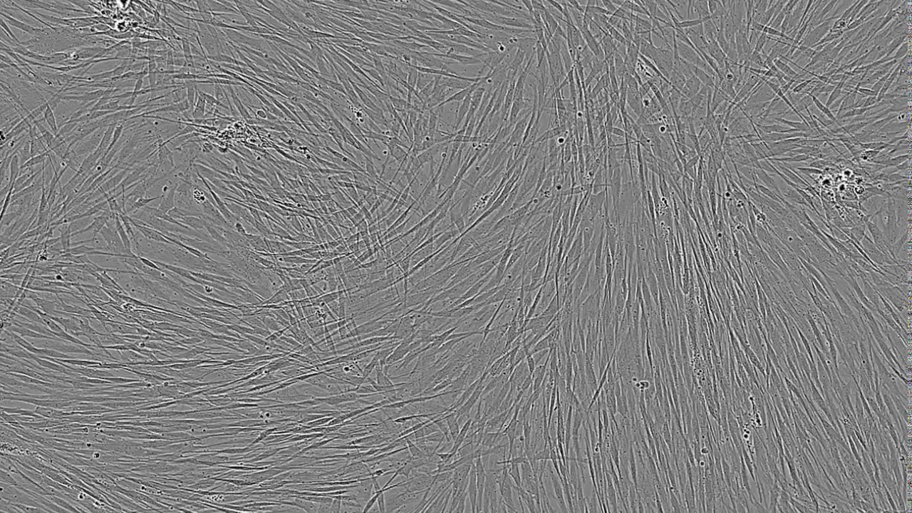 Osteogenic Differentiation of Human Mesenchymal Stem Cells