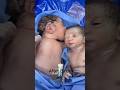 Preterm twins. How one baby sleeps and other tries to awake him with musical first cry #shorts