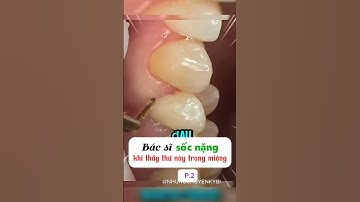 [P.2] Bác sĩ sốc nặng khi thấy thứ này bên trong miệng. #shorts