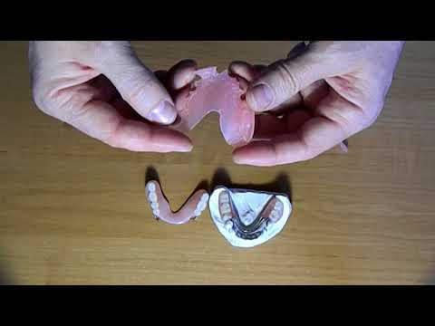 Нейлоновые зубные протезы-"плюсы"и "минусы"