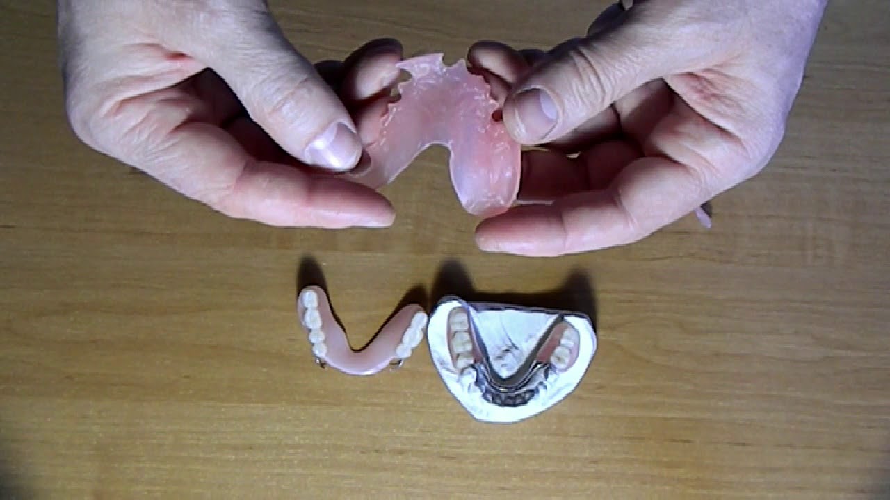 Нейлон плюсы и минусы. Плюсы и минусы нейлоновых протезов. Нейлоновый зубной протез плюсы и минусы. Нейлоновые протезы для зубов плюсы и минусы.