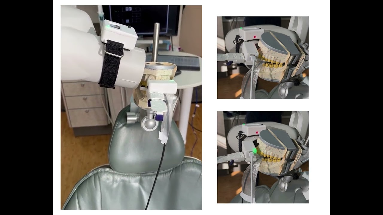 LunaLite Laser-Guided Bluetooth System: Now Under Clinical Testing for Bisecting Technique