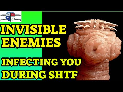 How to Use Black Walnut Hulls to Kill Horrific Parasitic Infections - Post Collapse Prepper Medicine