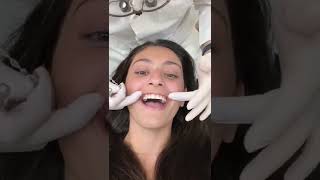 Surprise Immediate Reaction to Braces Removal with TheBracesDoc