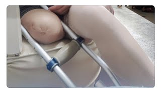 The Beautiful Woman With An Amputated Leg Challenges The Disability Of Walking With Crutches #Amp