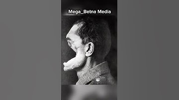 #eritrean #news #eritreanfilm #duet #eritreanmusic #eritreanmovie #aviation #eritreancomedy #habesha