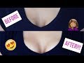 How To LIFT & FIRM BREAST in 1 Week