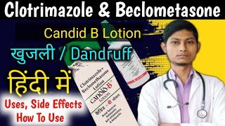 Candid b lotion (हिंदी में) | candid b lotion for hair how to apply |  canazole b lotion how to use - YouTube