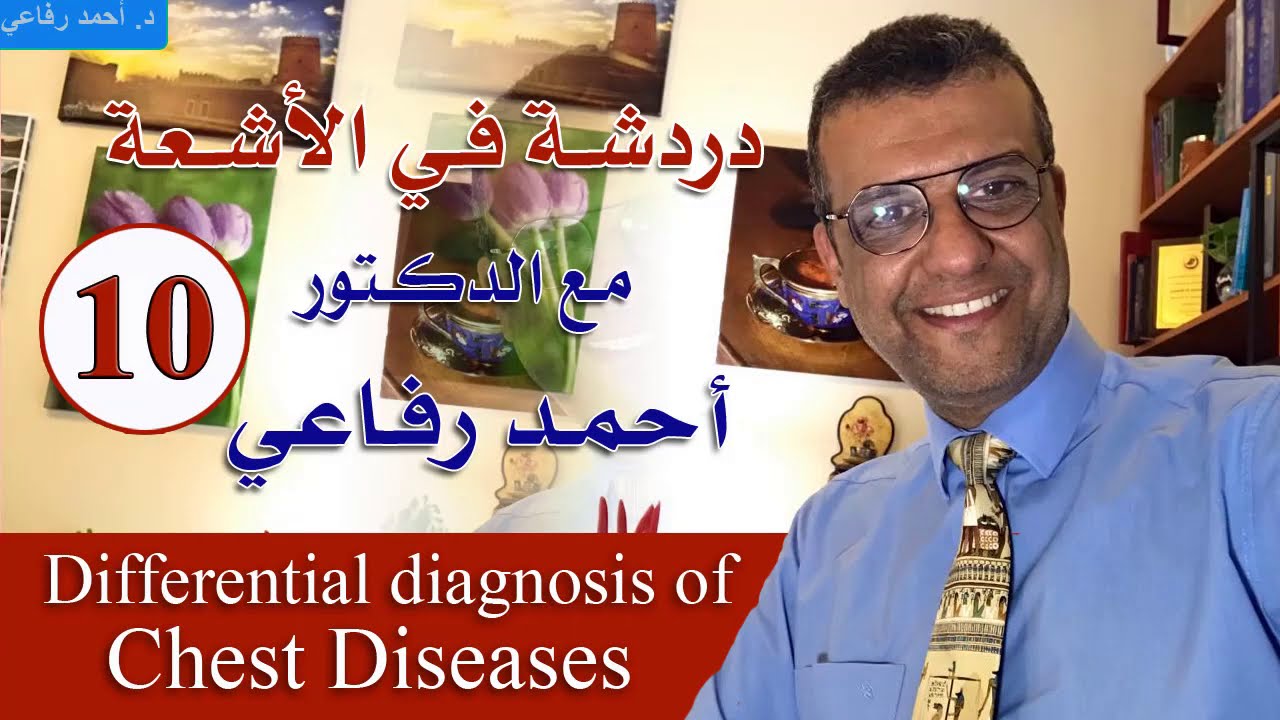 دردشة فى الأشعة 10- differential diagnosis of chest diseases - د. أحمد رفاعي