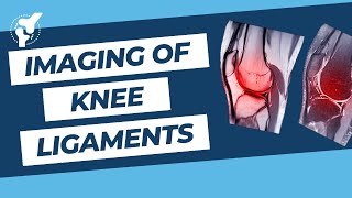 Imaging of Knee (ACL , PCL , Collateral ligaments)   MRI and Xray interpretation