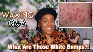 Why Do I Get White Bumps After Waxing? | Adore Her Beauty
