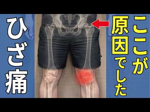 The Surprising Root Cause of Your Knee Pain | Sakato Orthopedic Clinic, Miyakojima Ward, Osaka #164