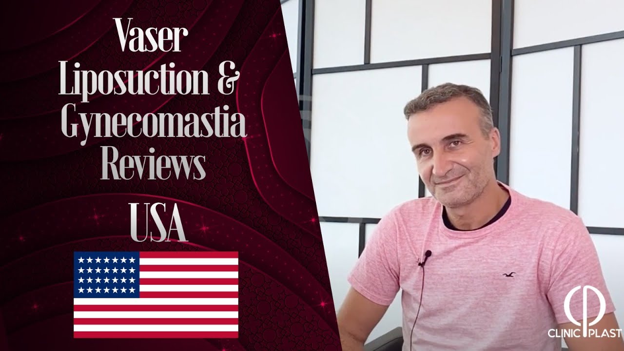 Vaser Liposuction & Gynecomastia Reviews | Clinicplast - YouTube