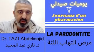 مرض التهاب اللثة : أسبابه، أعراضه و علاجه • La parodontite