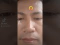 MixTiktokVideo#fypシ #foryoupage#funnyshorts (4)