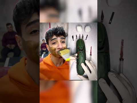 اغبى زبون جرودي بدو دقن يحيى حراقه