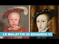 Le malattie di Edoardo VI: Re d'Inghilterra figlio di Enrico VIII