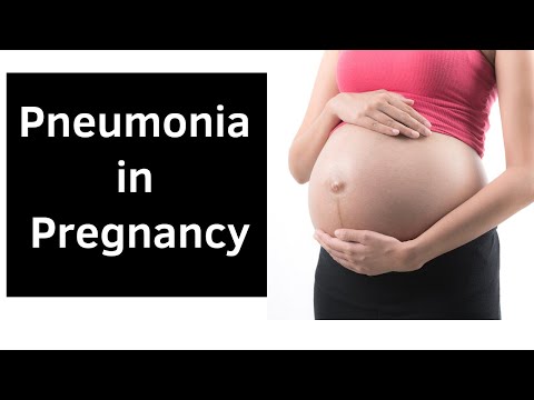 Pneumonia during Pregnancy: Causes, Symptoms and Treatment