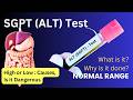 What is SGPT Test | ALT Test | Normal Levels, Price, Procedure, High SGPT/ALT Causes | Explained