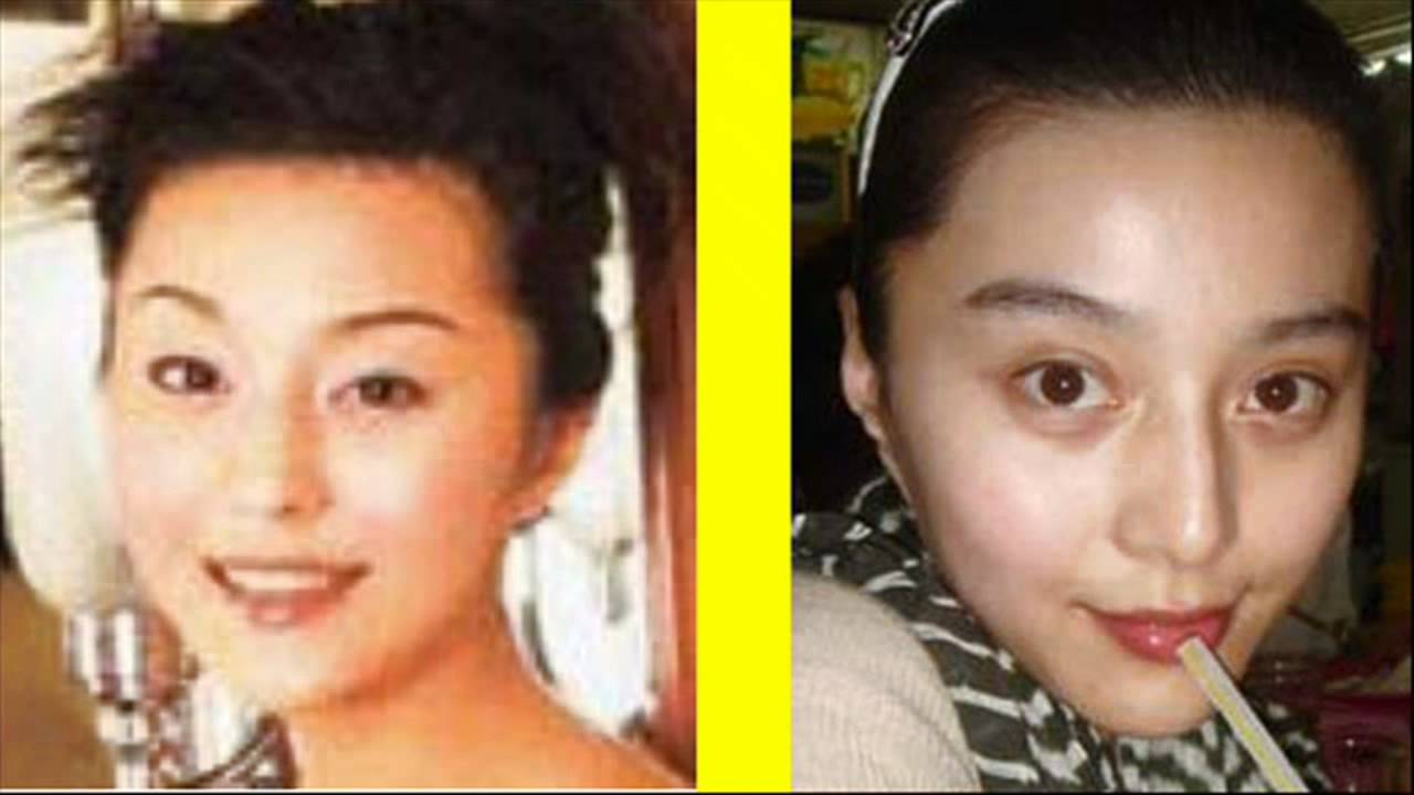 plastic, surgery, cosmetic, before, after, Jackie, Chan, 成龍, 成龙, 陳港生, 陈港生, ...