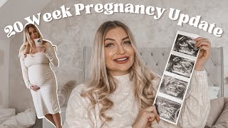 20-Week Anatomy Scan What To Expect | Anterior Placenta, Feeling Baby Movements, Finding Our Gender