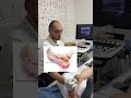 Пяточная шпора - Не Каблук ! #miofix